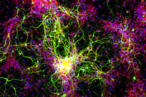 retinal ganglion cells